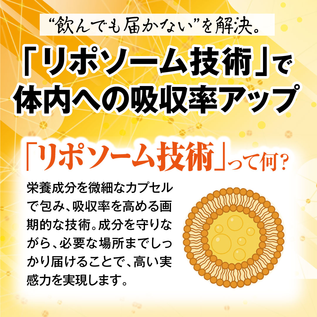 ��i�̉h�{�o�����X��ǋ������A�E�����`��A�z���T�v�������g